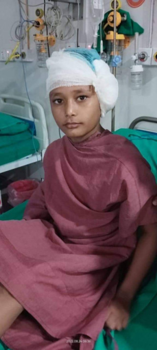 शिक्षकले बिधार्थिलाई पिट्दा कानको जाली फुट्यो ।